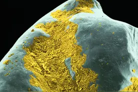 脏牙齿照片放大1000倍啥样？把它拿给娃看，从此主动天天刷牙图片