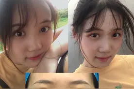 江苏美女天生一张幼态脸，奈何整形失败，“孩子眼”变“中年眼”图片