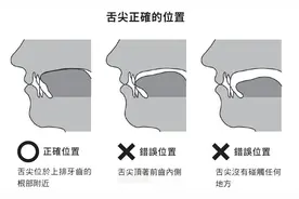舌头摆放不对影响一辈子！快自测你的对没对图片
