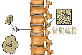 50岁左右的人，总感到浑身上下疼，是什么原因？该怎么办？图片