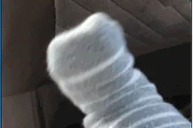 【医聊】哎呀，又崴脚了！踝关节求关注~图片