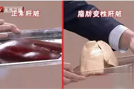 最新研究：轻度脂肪肝也会增加死亡风险！逆转脂肪肝，这些误区别中招，否则更危险图片