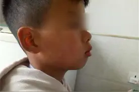 挺可爱的孩子结果越长越丑，甚至像“猩猩”？检查之后宝妈后悔了图片