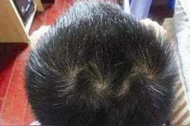 两个“旋”的男生聪明，而女生两个“旋”就是脾气暴躁？不可信图片