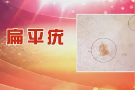 身上突然长了疙瘩，千万别随意抠！符合这些特征的，恐是肿瘤前兆！学会判别早应对图片