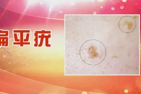 身上突然长了疙瘩，千万别随意抠！符合这些特征的，恐是肿瘤前兆！学会判别早应对图片