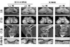 多种特殊状态下关节软骨缺损修复的组织工程技术图片