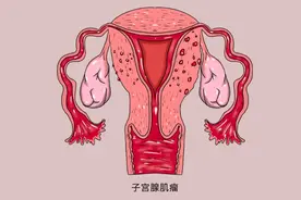生理期结束后，为什么小腹还是疼痛难忍？不一定都是痛经惹的祸图片