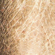 鱼鳞病发病年龄