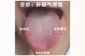 容易生闷气怎么办？图片