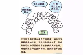 孩子牙缝大需要矫正吗？图片