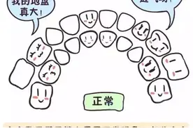 孩子牙缝大需要矫正吗？图片
