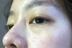 皮肤白也不好？脸上的几个缺点很明显，你有吗图片