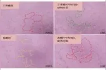 6-磷酸果糖激酶-2/果糖-2，6-二磷酸酶3对人脐静脉内皮细胞管腔形成的影响图片