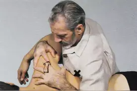 扎心了，上交叉综合征（治疗篇）图片