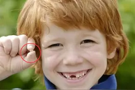 儿童换牙顺序图：孩子几岁换？怎么换？一文说清图片