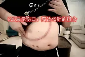 PDD复查遭医生警告：再不控制人就没了，直言自己很难撑到40岁图片
