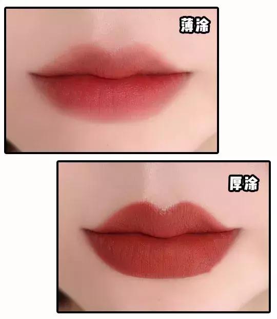 婴儿唇珠掉皮怎么办