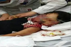 太残忍！3岁女童和奶奶遭男子持铁锹殴打，1死1重伤！警方通报来了图片