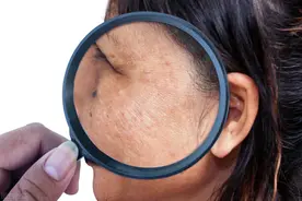 超级黄皮如何变白，像变白的姐妹们，这些变白的方法亲测有效噢图片