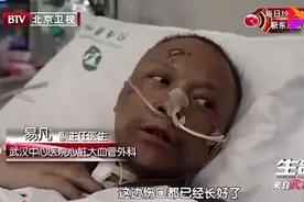 武汉医生皮肤变黑的原因找到！已慢慢恢复图片