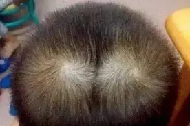 为什么有的孩子头上有“2个旋”？有什么含义，看完涨知识图片