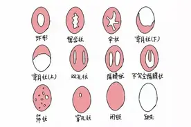 处女的第一次都会流血吗？会不会有例外？一次性科普到位图片