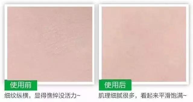 美肌冻干粉有什么作用 美肌冻干粉有什么作用和功效