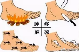 糖尿病下肢动脉病变，肢端麻凉疼，这种情况该如何治疗？图片