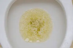 ​上厕所时，尿液泡沫多，是蛋白尿，肾功不全吗？别傻傻的不懂图片