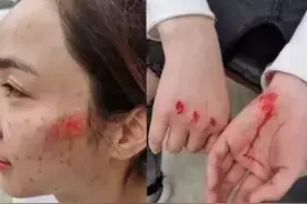 姑娘，你的脸……心疼！图片