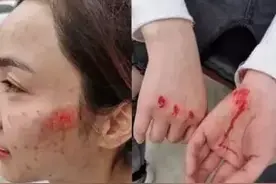 姑娘，你的脸……心疼！图片
