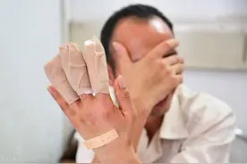 员工在上班期间因违规操作不慎受伤，可以认定为工伤吗？图片
