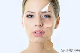 为什么有些人用水杨酸爆痘快，有些人就慢得很？图片