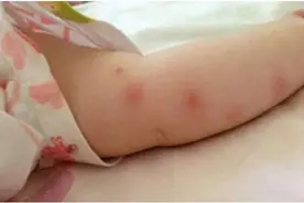 国外代购的驱蚊产品就很好用靠谱吗？扒清成分避雷图片