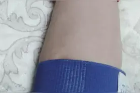 呼吁：看到胳膊上绑着红蓝两条绷带的人，请给他们让个座好吗？图片