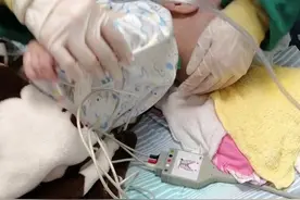 广东一婴儿诊断脑瘫，母亲找卫健局投诉放局里，送医救治10天去世，父亲做DNA要回遗体，涉事医院遭处罚图片