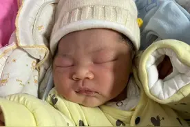 剖腹产的过程，女人必经的鬼门关图片