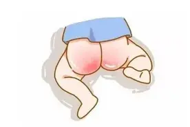 夏季避免宝宝红屁屁，家长要做到这几点图片