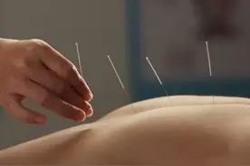 王乐亭针灸临证处方：中暑图片
