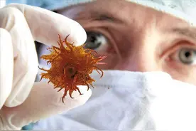 结节是肿瘤吗？癌变的几率有多大？医生带您了解身上的凸起、肿块图片