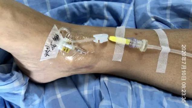 静脉输液部位选择不简单，一不小心竟“误入歧途”