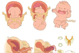 什么是顺产有哪些需要注意的事情？图片