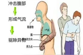 关键时刻，“爱的抱抱”可救命图片
