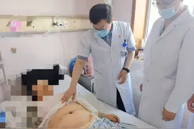 阑尾不仅会发炎，也会癌变！预防消化道肿瘤，专家提出三点建议图片