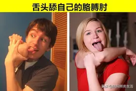 在这个世界上，只有极少数人才拥有的9个罕见的身体特征图片