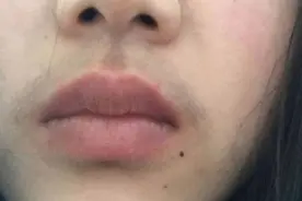 女生长胡子怎么回事？别着急去掉，明确原因再做决定图片