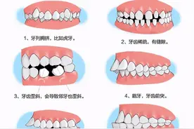 牙齿“正畸”知多少？#雅悦齿科#图片