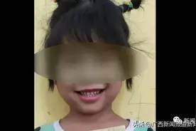 五岁半女孩拔牙意外离世，医院回应图片