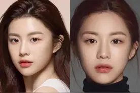 亲自设计自己的手术，美成整形模板，如今面部松弛下垂严重？图片